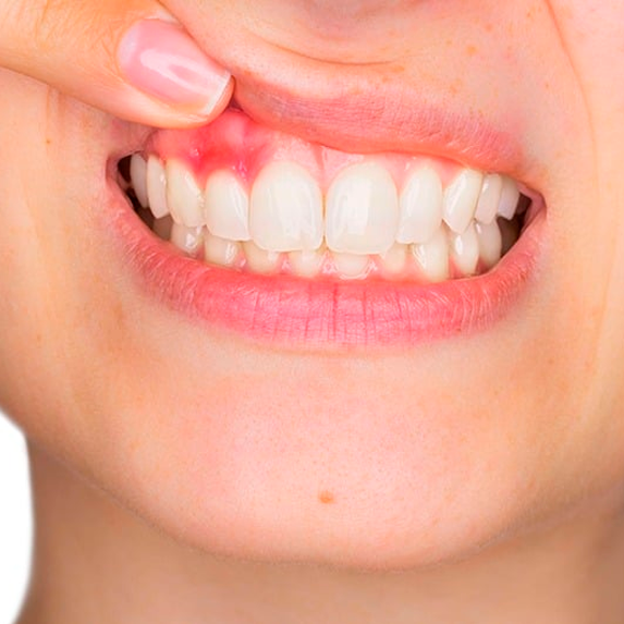 imagen Periodoncia
